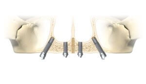 おーフオンフォーのイラスト