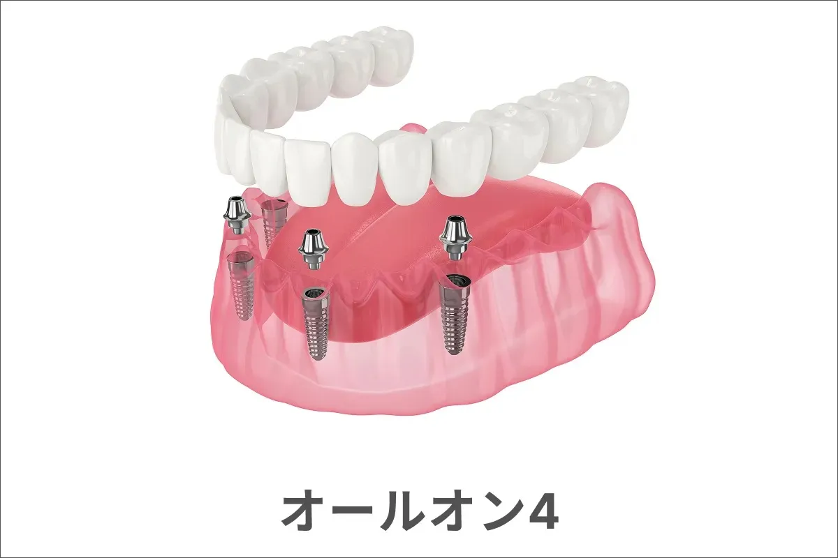 オールオン4のイメージ画像