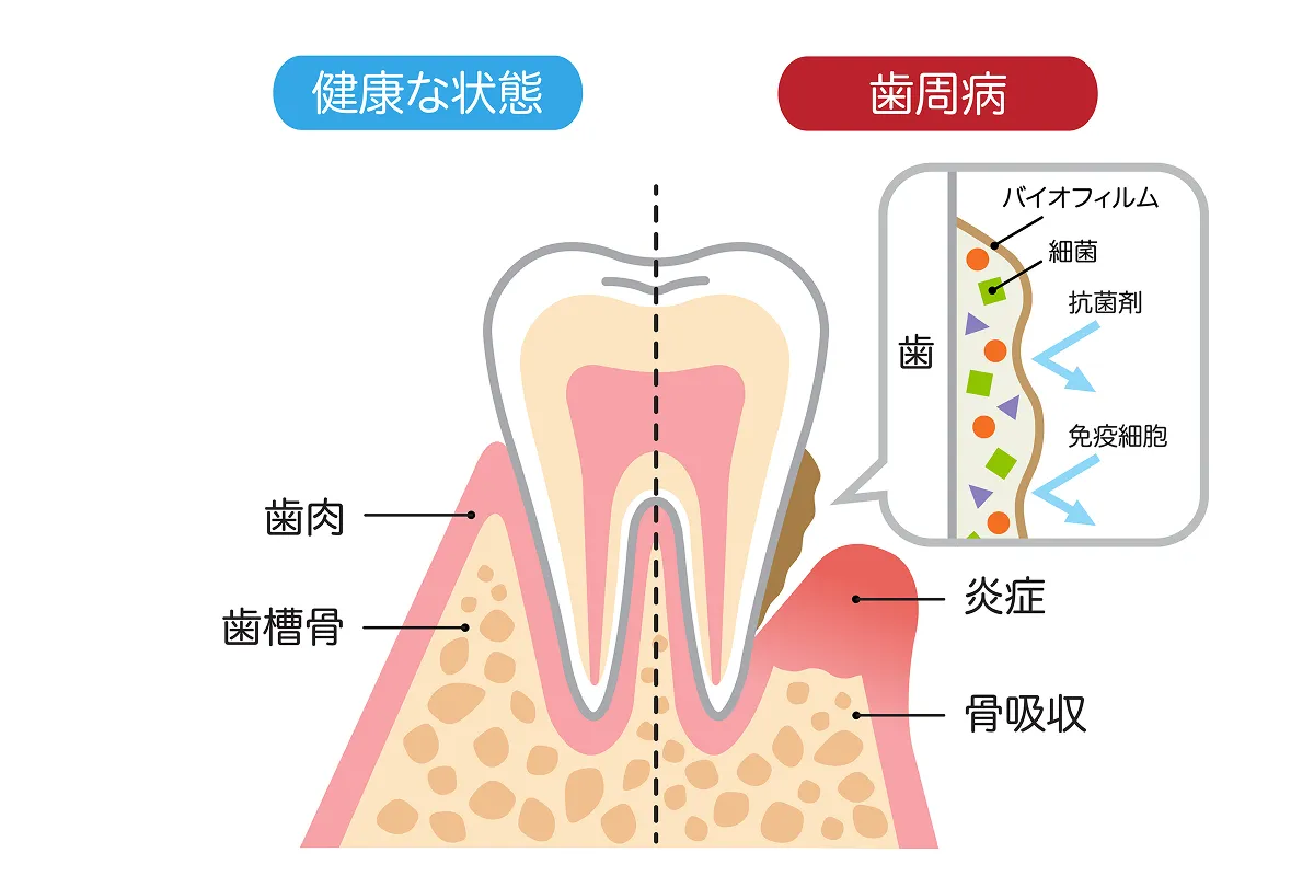 バイオフィルムのイメージ