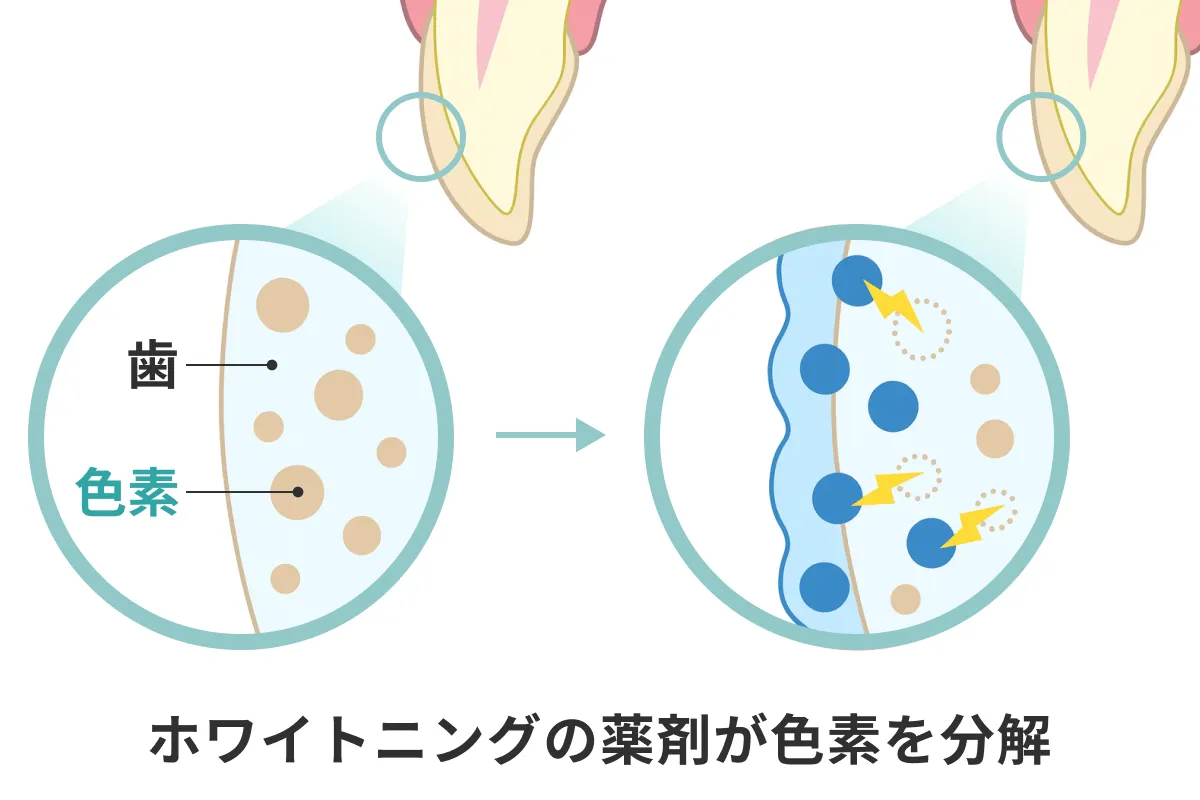 歯が白くなるメカニズム