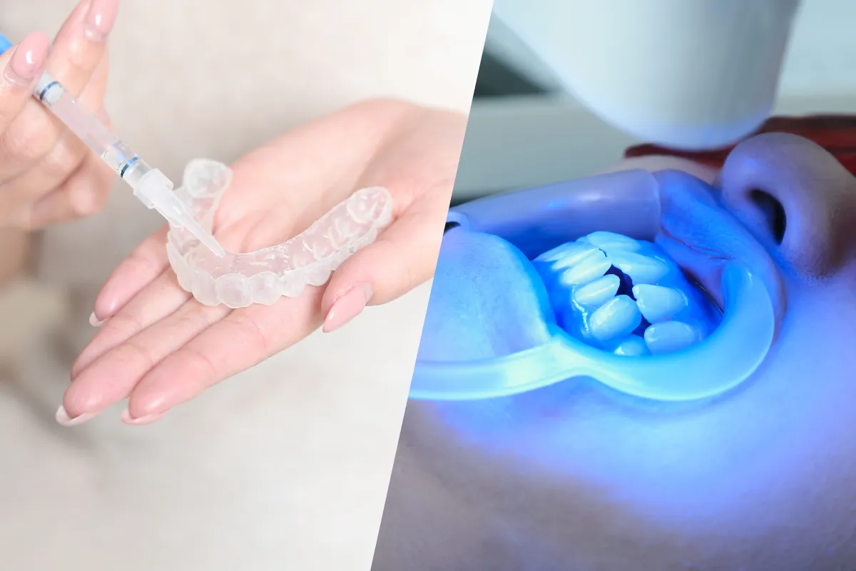 デュアルホワイトニング