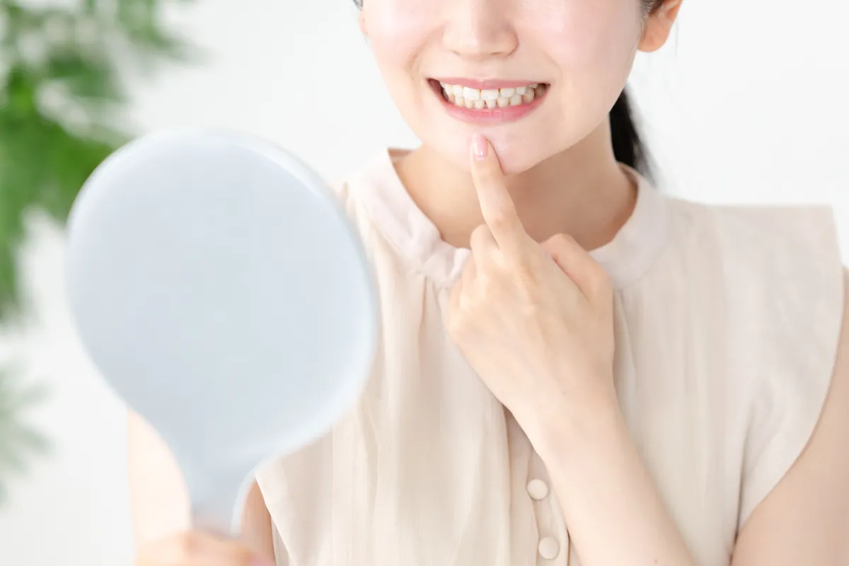 ダイレクトボンディングのイメージ