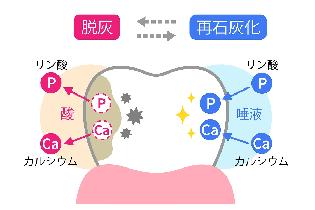 脱灰と再石灰化